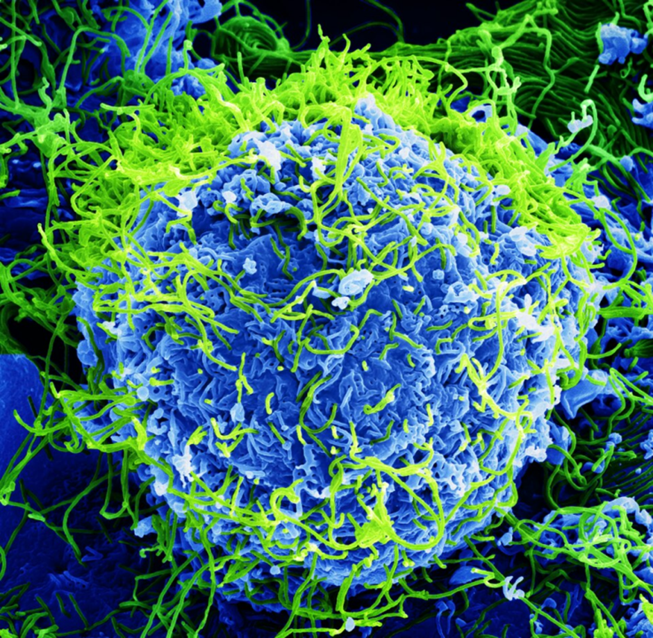 DRC Ebola: A Vaccine GAP, A Mineral War, And A Gutted Response System